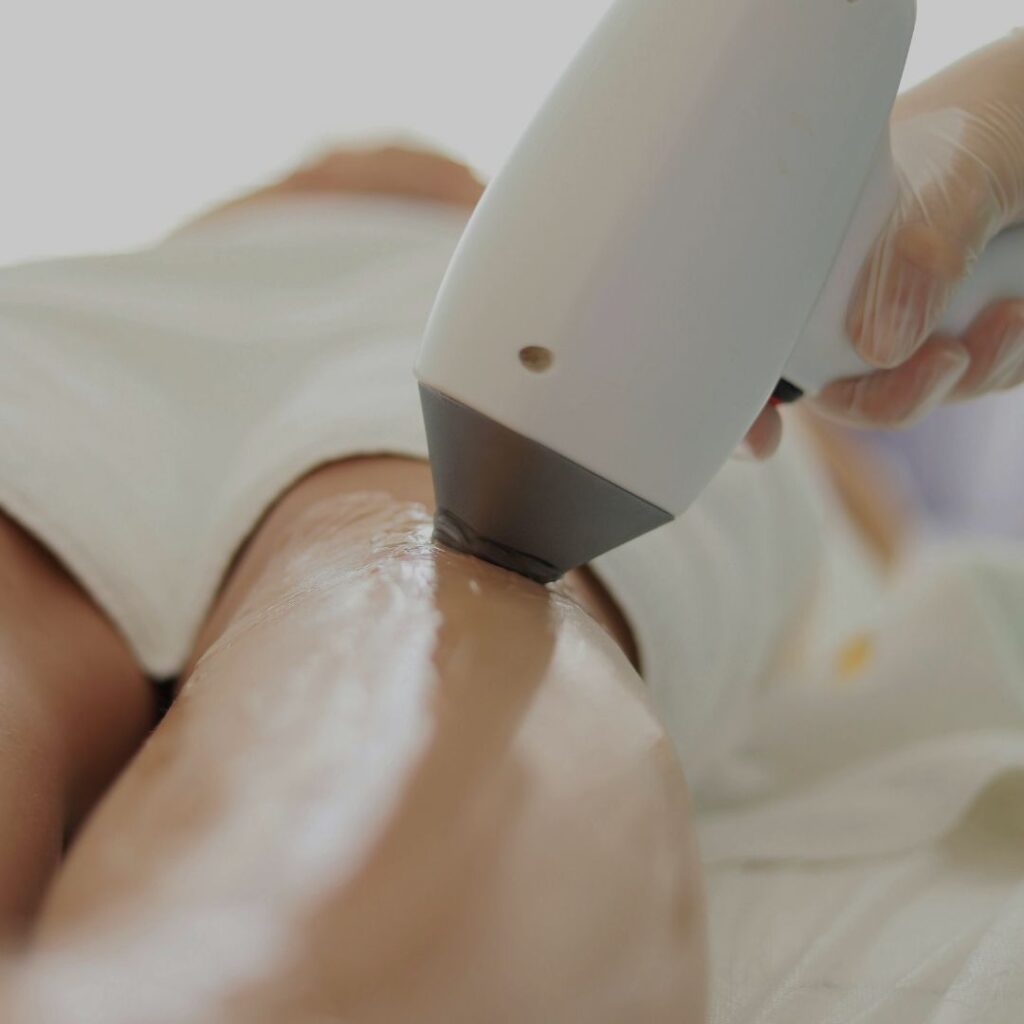 Dauerhafte Haarentfernung Sursee