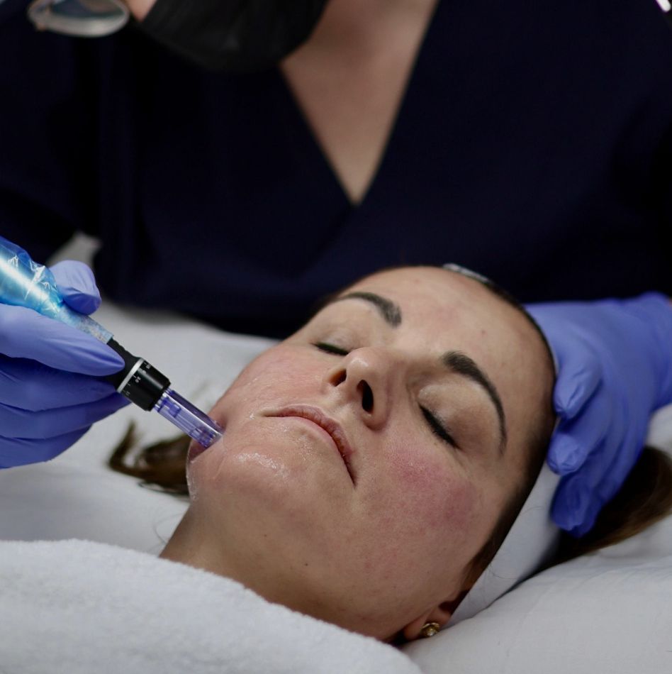 Needling (Micro & Nano) Sursee