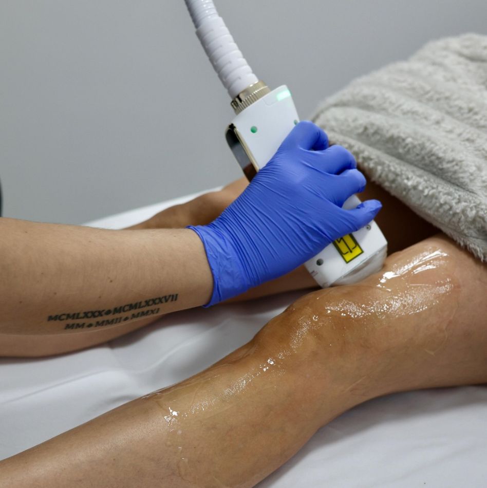 Dauerhafte Haarentfernung Sursee