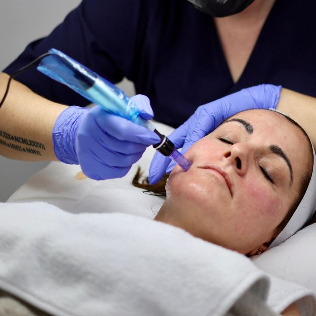 Needling Nanoneedling Beautify