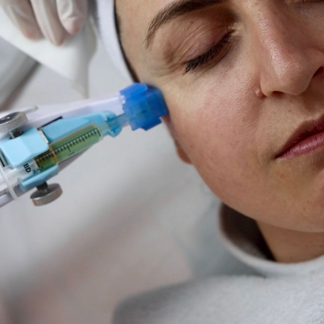 Beautify Mesotherapie Sursee